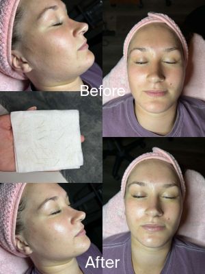 compress 20240109 231350