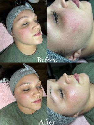 compress 20240109 231350