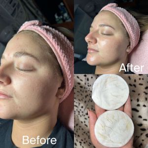 compress 20240109 231350